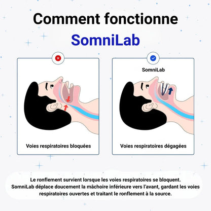 SOMNILAB™